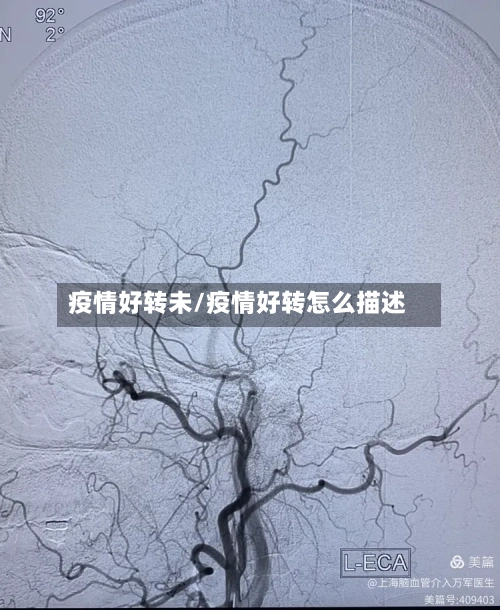 疫情好转未/疫情好转怎么描述-第3张图片